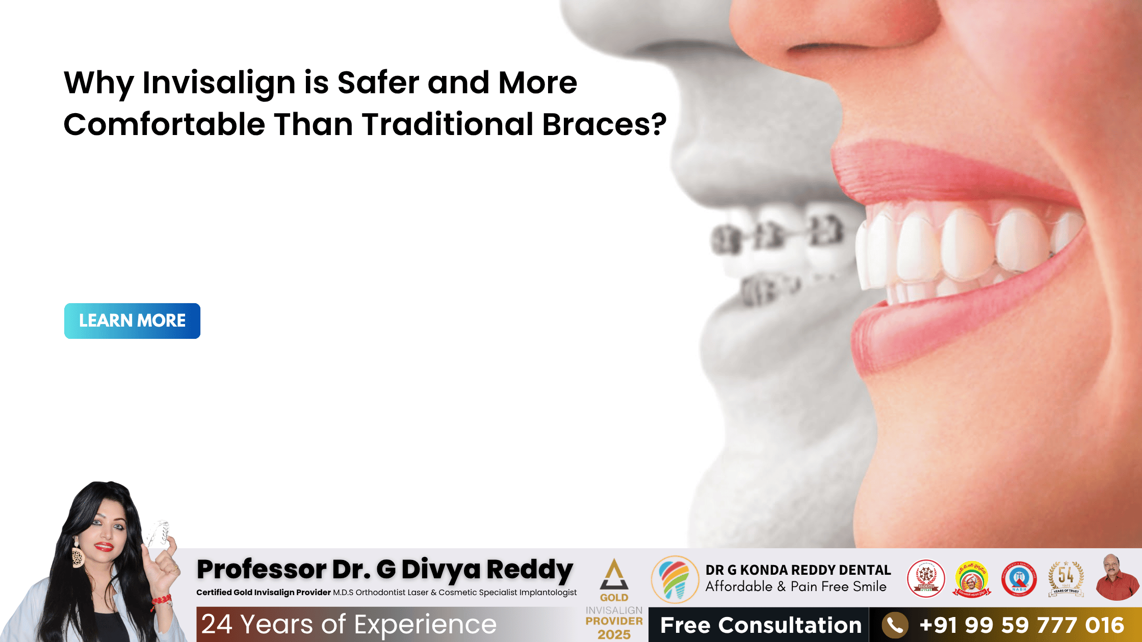 Why Invisalign is Safer and More Comfortable Than Traditional Braces – Insights from Nellore's Gold Invisalign Provider